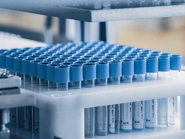 A tray of medical test tubes with blue caps